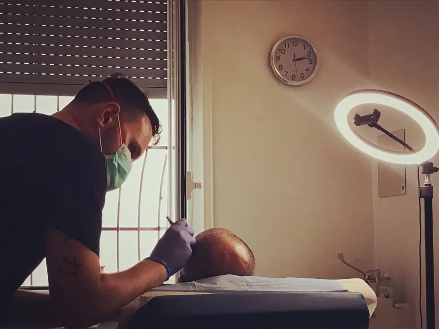 Centro medico tricopigmentazione Milano